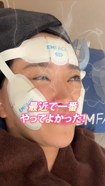 隠れ家のお勧め美肌クリニック〜〜！！☺️
📍ソウル・明洞 | リジンクリニック

＼私を見れば渡韓整形で迷わない！／
整形、こんなお悩みありませんか？💭

☑ どのクリニックを選べばいいか分からない
☑ 韓国で手術するのがちょっと怖い…
☑ 万が一の場合ひとりで交渉できるかな？

そんな不安、全部韓国在住の私にお任せください✨
整形は、人生が変わるビッグイベント。
今の自分に少しでもモヤモヤしてるなら…
“自分史上最高のわたし”になって、もっと前向きに生きられるお手伝いをします😊

まずはLINEでお気軽にご相談ください💌

#整形 #韓国整形 #美容整形 #韓国旅行 #垢抜け #ビフォーアフター #渡韓整形 #あやオンニ