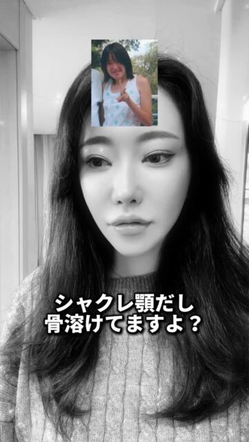 輪郭骨切り悩んでいる人は大阪集合〜🙌

輪郭・両顎・顔面骨格再建まで対応可能な、世界的にも数少ない高度な技術を持つ院長先生です✨
貴重なこの機会、人生を変えるチャンスです！

プロフリンクから
【相談会希望】って送ってね！✊