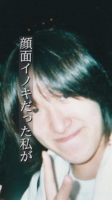 美容整形は人生を変える！！
#美容整形 #渡韓整形 #あやオンニ 
ーーーーーーーーーーーーーーーー
整形のことなら"あやオンニ"🇰🇷
💵総額2,020万円超のリアルガチ勢
✈️渡韓整形フルサポート
(通訳/ケア/同行)
🇰🇷政府公認
無料相談受付中✨
詳細はプロフィールの公式LINEをチェック！