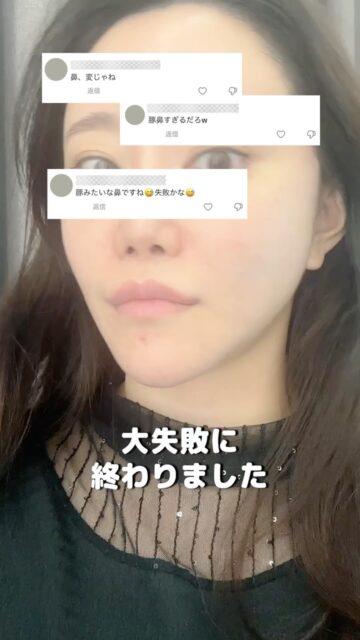【前回、即ソールドアウト！】
メイドヤング美容外科 × AYAKOREA
1日限定・東京特別カウンセリング会の開催が決定！🇰🇷🇯🇵✨

「東京でイ・ビョンフェ院長に直接相談したい！」という多くのお声にお応えして、再び東京へ💎
👨‍⚕️鼻整形専門 イ・ビョンフェ院長
・鼻整形20年の豊富な経験
・派手鼻から自然鼻まで幅広く対応
・難易度の高い鼻の再手術・修正・再建手術にも対応

「自分にはどんな鼻が似合う？」
「過去の鼻整形を修正したい」
「自然だけど、しっかり変化も欲しい」
そんなお悩みを、院長先生へ東京で直接ご相談いただける特別な機会です✨

【1日限定・東京相談会】
2026年9月12日（土）
9:30〜19:00
📍会場：東京都内
さらに、相談会限定の特別割引や特典もたっぷりご用意しております🎁

前回はすぐに満席となったため、気になる方はお早めにご応募ください！
参加をご希望の方は、プロフィールのリンクからLINEを追加し、
【相談会希望】とメッセージを送ってください💌