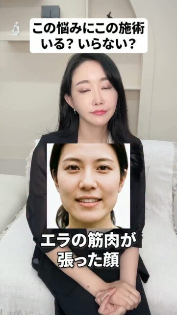 その小顔施術、いる？いらない？
#美容整形 #渡韓整形 #あやオンニ
ーーーーーーーーーーーーーーー
整形のことなら"あやオンニ"🇰🇷
💵総額2,360万円超のリアルガチ勢
✈️渡韓整形フルサポート
(通訳/ケア/同行)
🇰🇷政府公認
無料相談受付中✨
詳細はプロフィールの公式LINEをチェック！